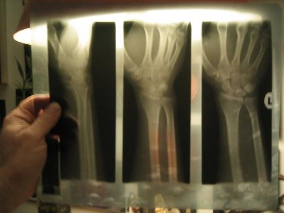 X-Ray2.jpg